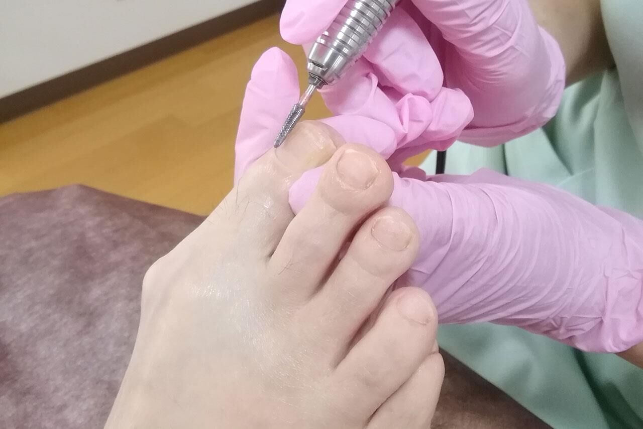 天使のつめきり静岡 メディカル フットケアを一度ご利用ください